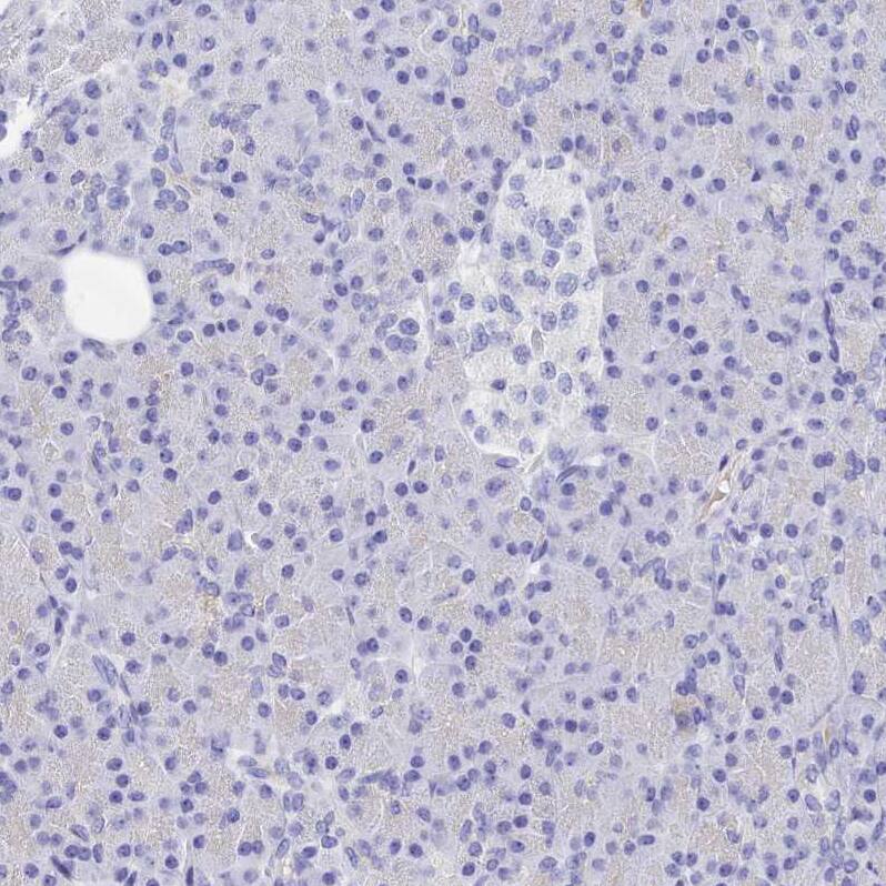 TRIM10 Antibody - BSA Free Immunohistochemistry: TRIM10 Antibody - BSA Free [NBP2-13479]
