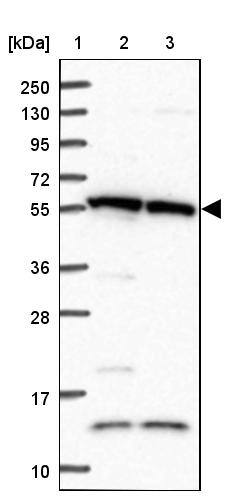 TRIM27 Antibody - BSA Free Western Blot: TRIM27 Antibody - BSA Free [NBP2-13482]