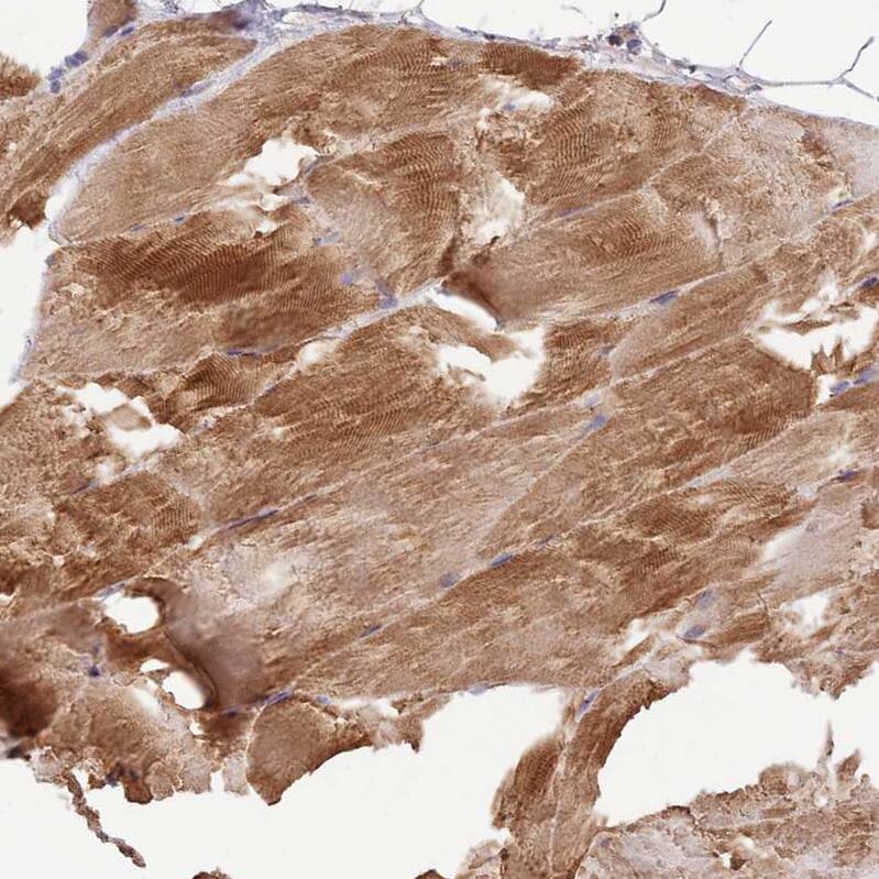 TRIM32 Antibody - BSA Free Immunohistochemistry: TRIM32 Antibody - BSA Free [NBP2-13484]