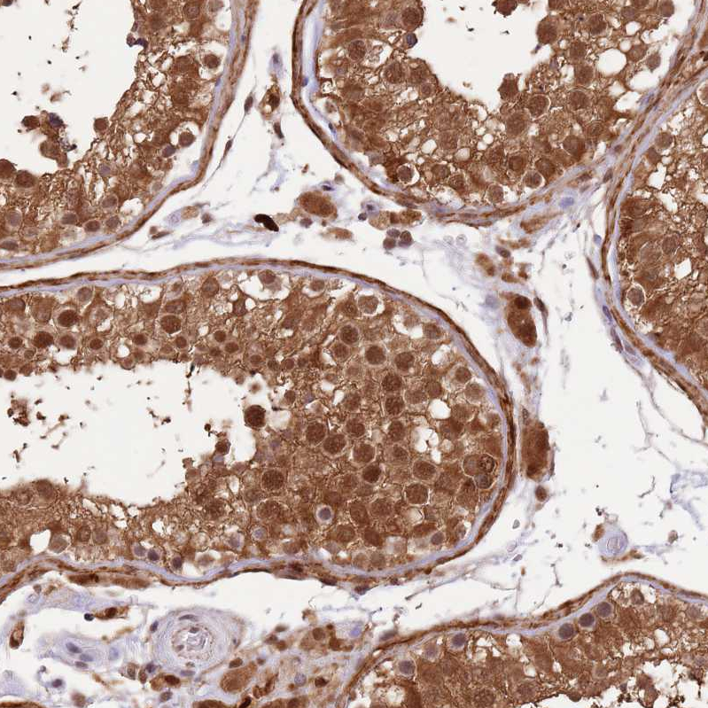 TRIM32 Antibody - BSA Free Immunohistochemistry: TRIM32 Antibody - BSA Free [NBP2-13484]