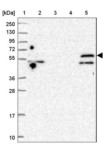 TRIM32 Antibody - BSA Free Western Blot: TRIM32 Antibody - BSA Free [NBP2-13484]