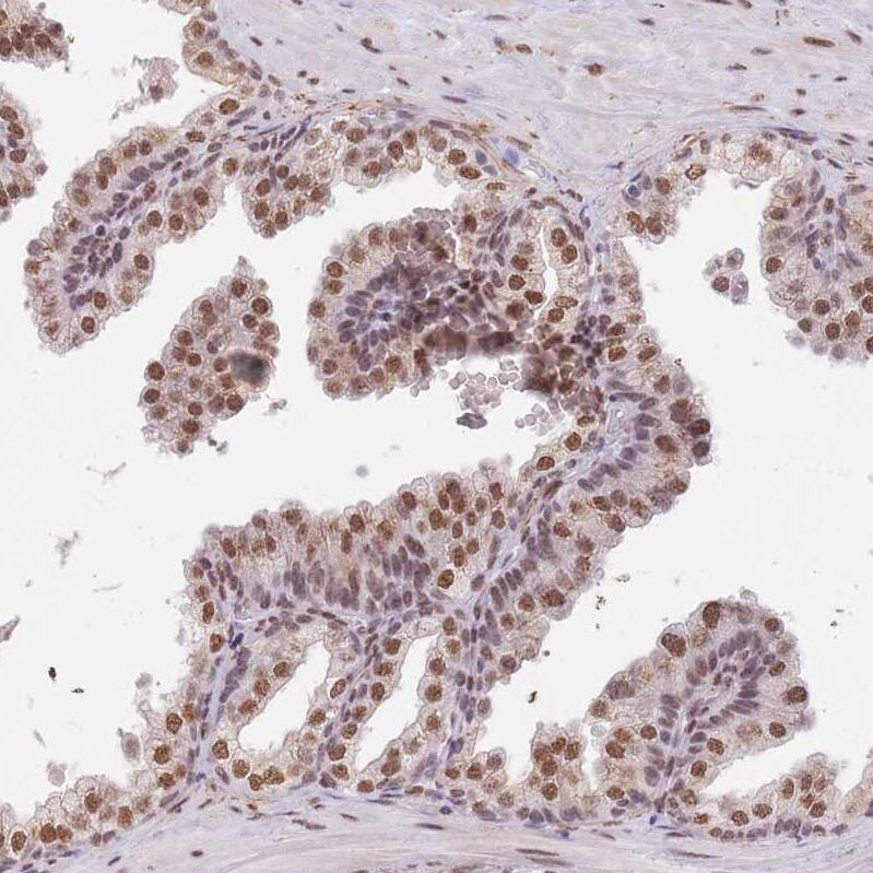 TRIM32 Antibody - BSA Free Immunohistochemistry: TRIM32 Antibody - BSA Free [NBP2-13484]
