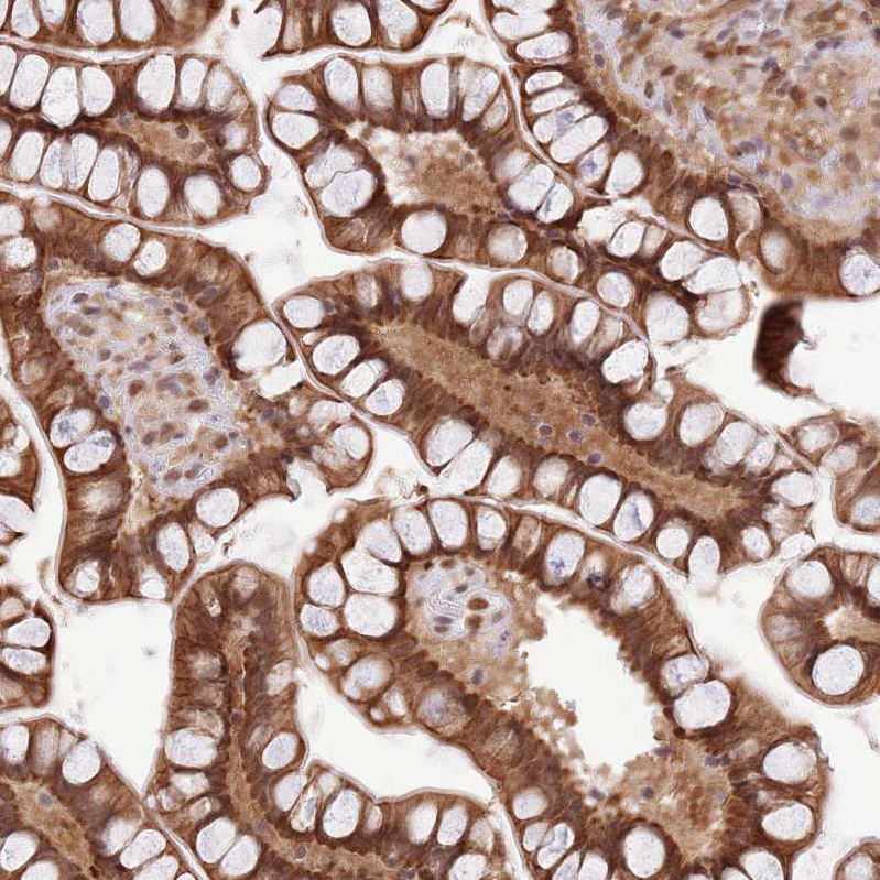 TRIM32 Antibody - BSA Free Immunohistochemistry: TRIM32 Antibody - BSA Free [NBP2-13484]