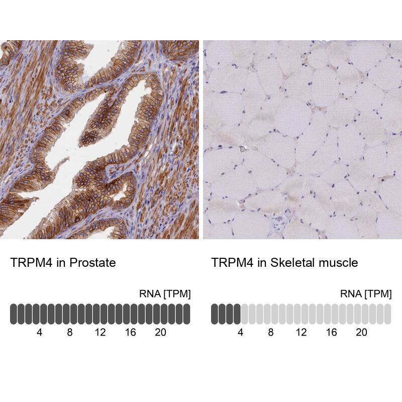 TRPM4 Antibody - BSA Free Immunohistochemistry: TRPM4 Antibody - BSA Free [NBP2-13487]