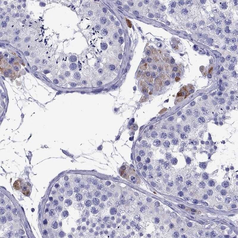 TTLL13 Antibody - BSA Free Immunohistochemistry-Paraffin: TTLL13 Antibody [NBP2-13492]