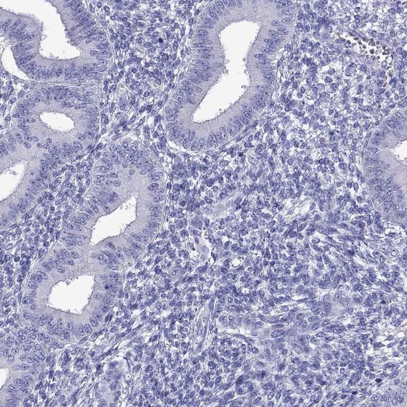 TTLL13 Antibody - BSA Free Immunohistochemistry-Paraffin: TTLL13 Antibody [NBP2-13492]