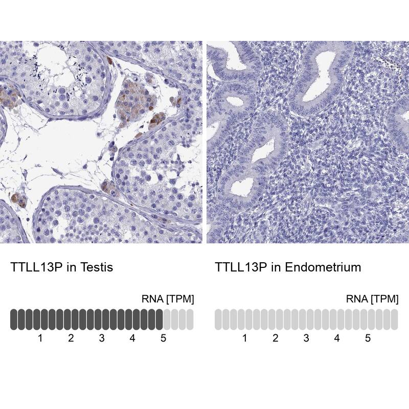 TTLL13 Antibody - BSA Free Immunohistochemistry: TTLL13 Antibody - BSA Free [NBP2-13492]