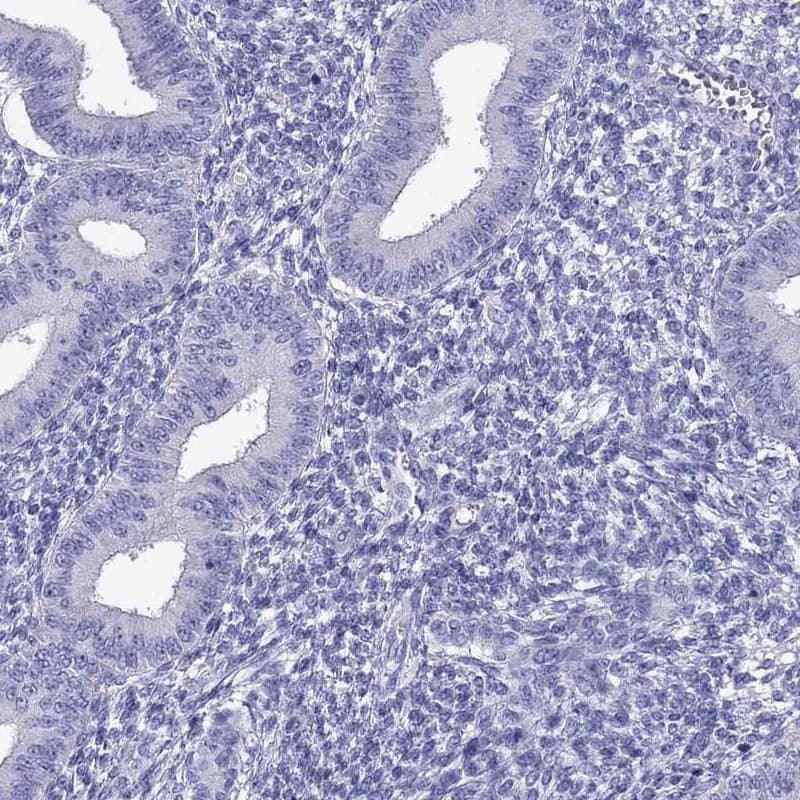 TTLL13 Antibody - BSA Free Immunohistochemistry: TTLL13 Antibody - BSA Free [NBP2-13492]