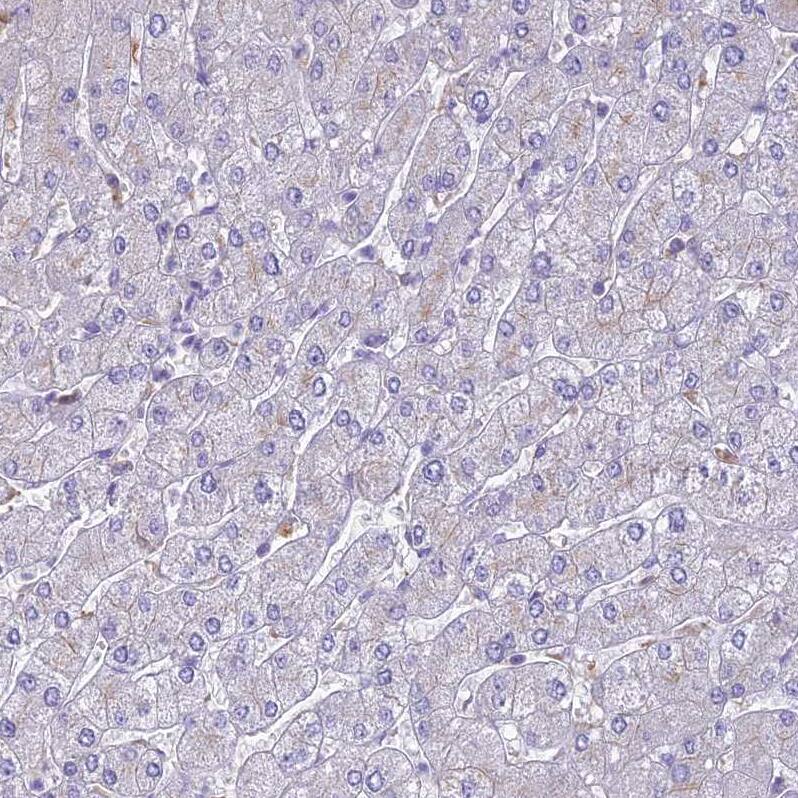 UBE2G1 Antibody - BSA Free Immunohistochemistry: UBE2G1 Antibody - BSA Free [NBP2-13499]
