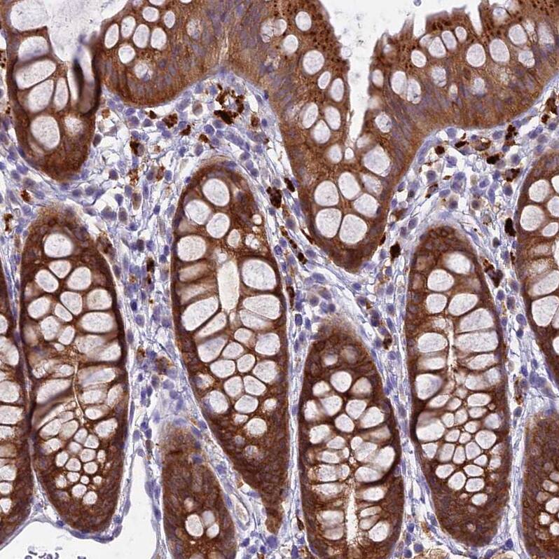 UBE2G1 Antibody - BSA Free Immunohistochemistry: UBE2G1 Antibody - BSA Free [NBP2-13499]