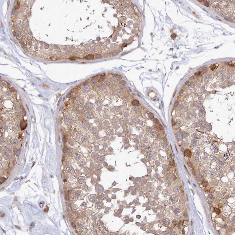 UBE2G1 Antibody - BSA Free Immunohistochemistry: UBE2G1 Antibody - BSA Free [NBP2-13500]