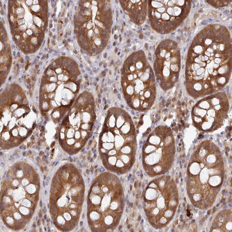 UBE2G1 Antibody - BSA Free Immunohistochemistry: UBE2G1 Antibody - BSA Free [NBP2-13500]