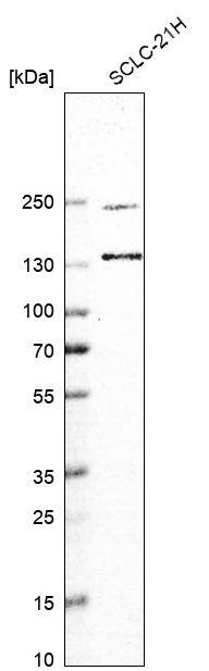 UBE2O Antibody - BSA Free Western Blot: UBE2O Antibody - BSA Free [NBP2-13501]