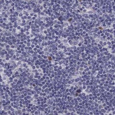 UHRF1 Antibody - BSA Free Immunohistochemistry: UHRF1 Antibody - BSA Free [NBP2-13504]