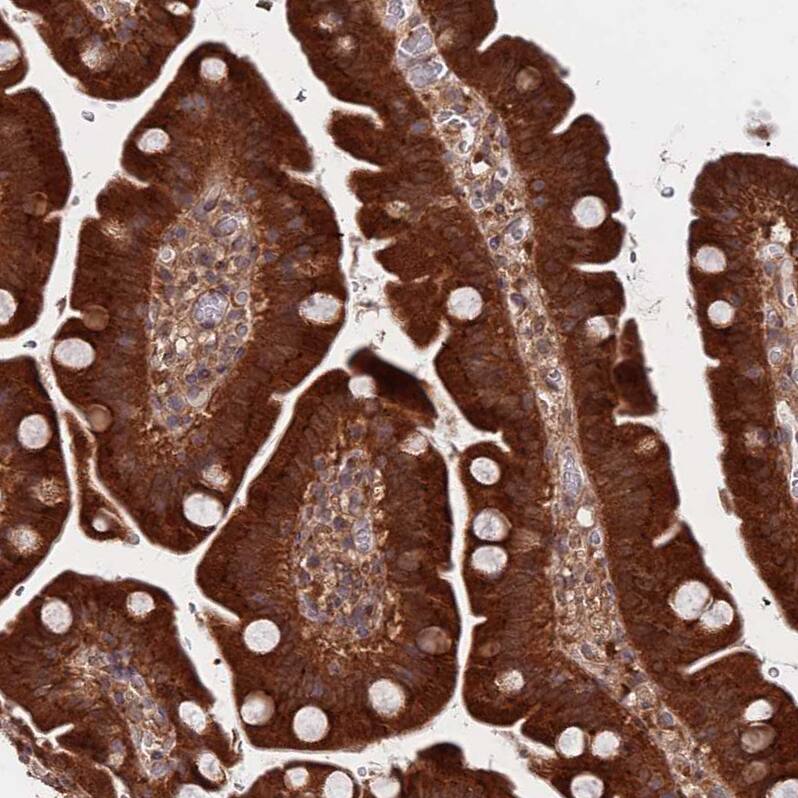 UNC45A Antibody - BSA Free Immunohistochemistry: UNC45A Antibody - BSA Free [NBP2-13506]