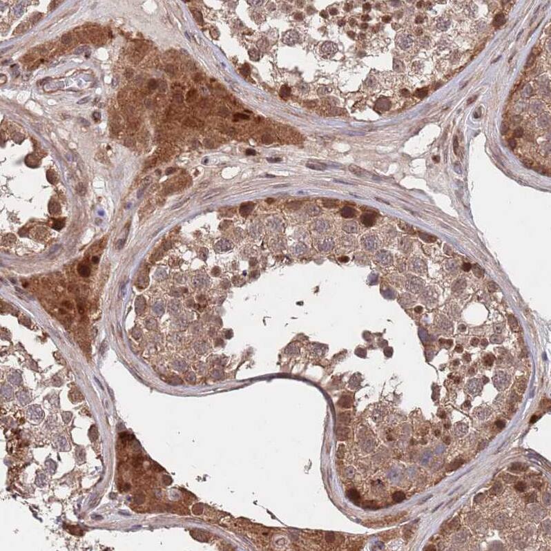 UNC45A Antibody - BSA Free Immunohistochemistry: UNC45A Antibody - BSA Free [NBP2-13506]