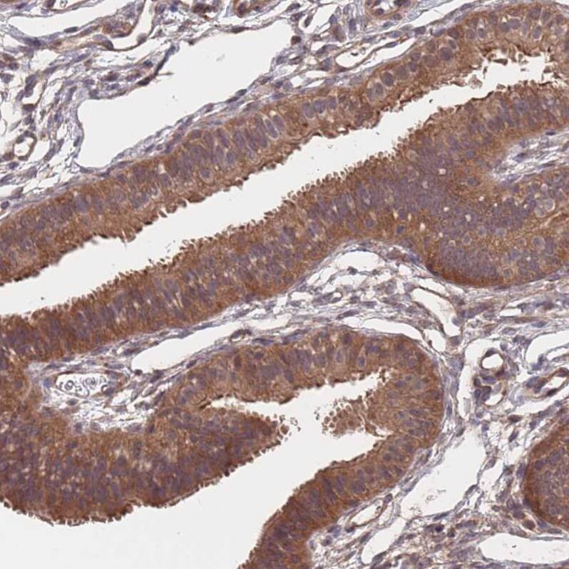 UNC45A Antibody - BSA Free Immunohistochemistry: UNC45A Antibody - BSA Free [NBP2-13506]
