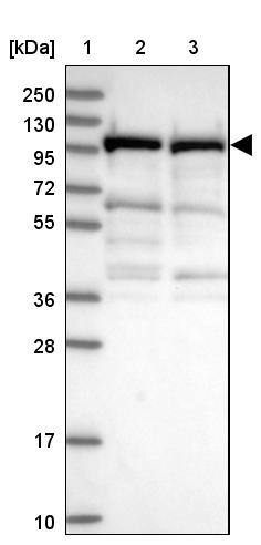 UNC45A Antibody - BSA Free Western Blot: UNC45A Antibody - BSA Free [NBP2-13506]