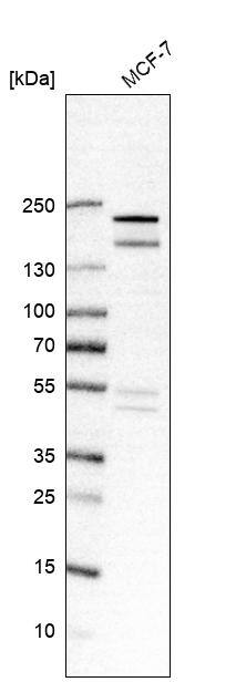 USP32 Antibody - BSA Free Western Blot: USP32 Antibody - BSA Free [NBP2-13509]