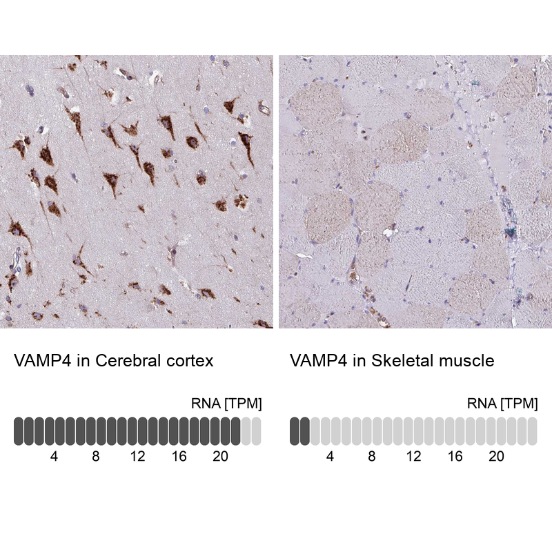 VAMP4 Antibody - BSA Free Immunohistochemistry: VAMP4 Antibody - BSA Free [NBP2-13512]