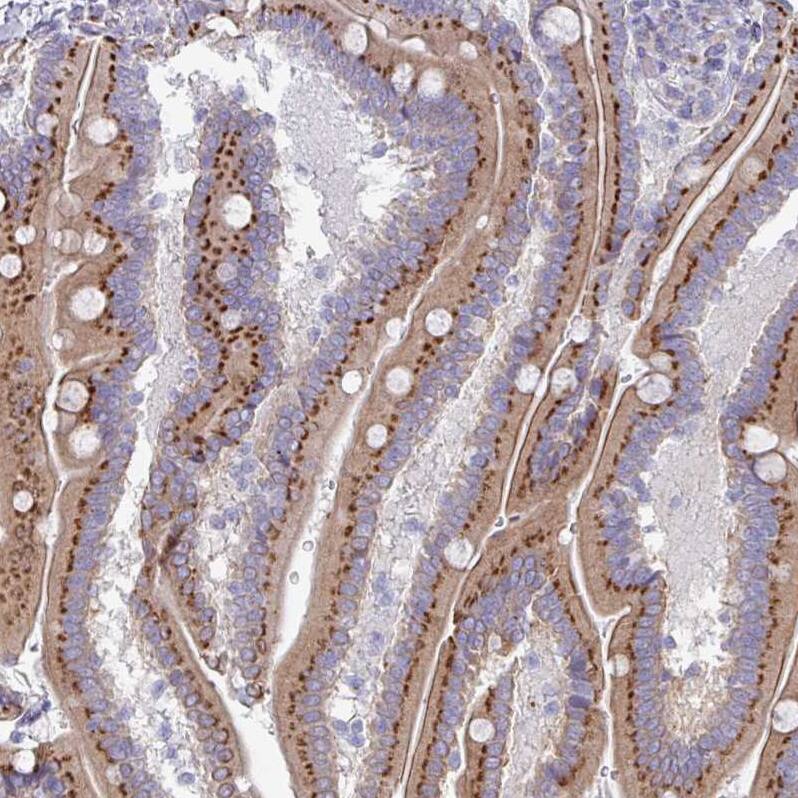 VKORC1L1 Antibody - BSA Free Immunohistochemistry: VKORC1L1 Antibody - BSA Free [NBP2-13516]