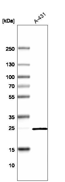 VKORC1L1 Antibody - BSA Free Western Blot: VKORC1L1 Antibody - BSA Free [NBP2-13516]