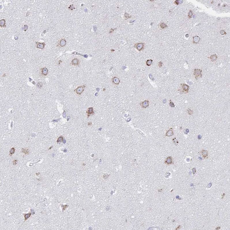 VKORC1L1 Antibody - BSA Free Immunohistochemistry: VKORC1L1 Antibody - BSA Free [NBP2-13516]