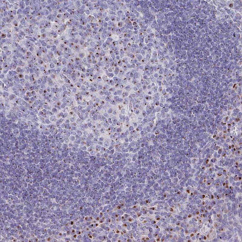 VKORC1L1 Antibody - BSA Free Immunohistochemistry: VKORC1L1 Antibody - BSA Free [NBP2-13516]
