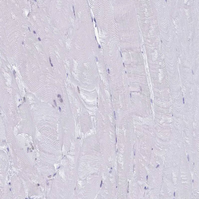 VKORC1L1 Antibody - BSA Free Immunohistochemistry: VKORC1L1 Antibody - BSA Free [NBP2-13516]