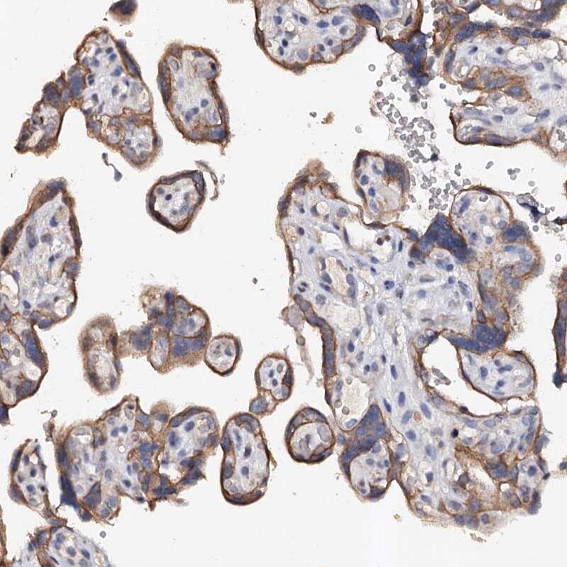 VPS36 Antibody - BSA Free Immunohistochemistry: VPS36 Antibody - BSA Free [NBP2-13518]