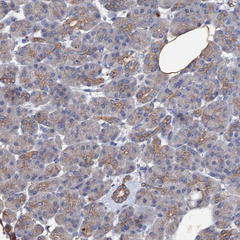 VPS36 Antibody - BSA Free Immunohistochemistry: VPS36 Antibody - BSA Free [NBP2-13518]