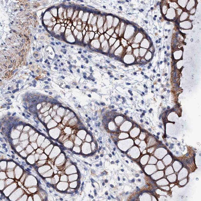 VPS36 Antibody - BSA Free Immunohistochemistry: VPS36 Antibody - BSA Free [NBP2-13518]