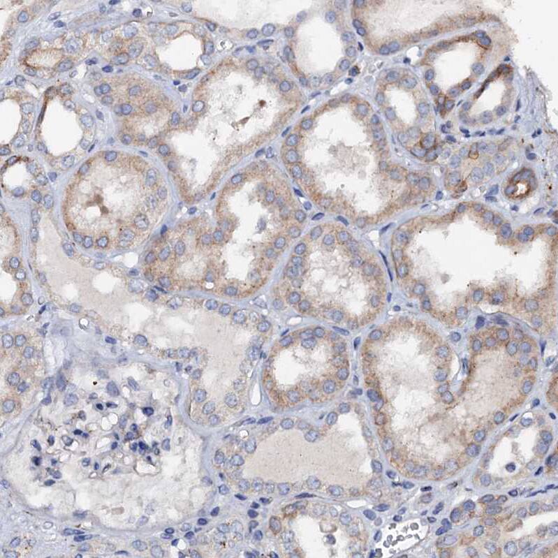 VPS36 Antibody - BSA Free Immunohistochemistry: VPS36 Antibody - BSA Free [NBP2-13518]