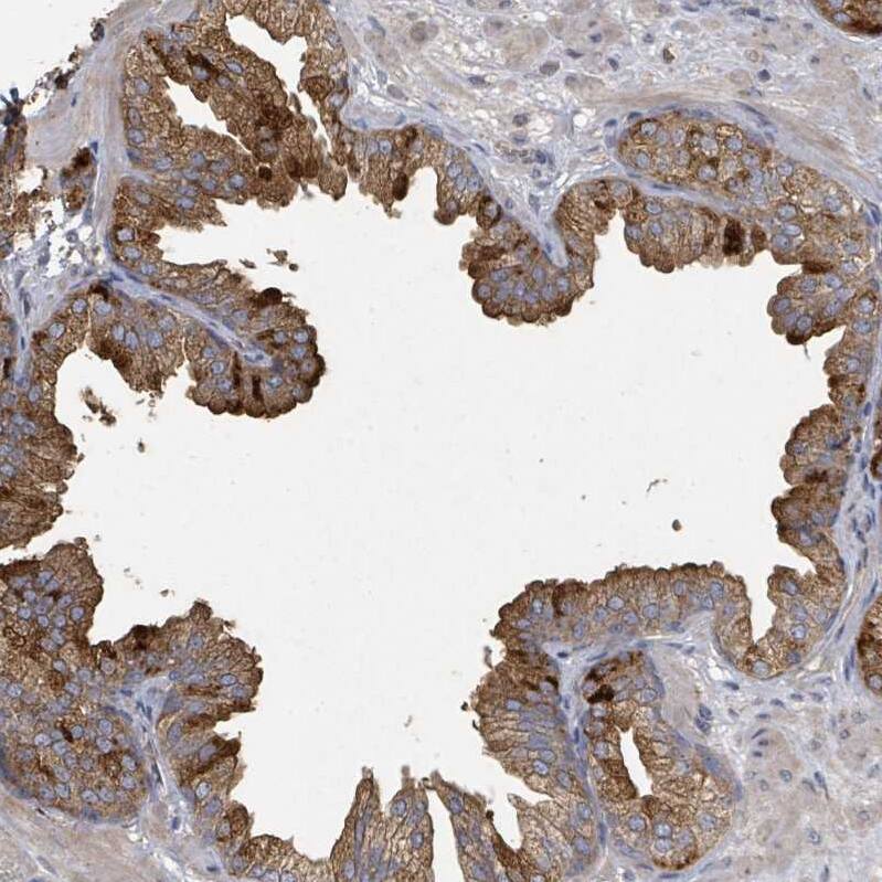 FENS1 Antibody - BSA Free Immunohistochemistry: FENS1 Antibody - BSA Free [NBP2-13521]
