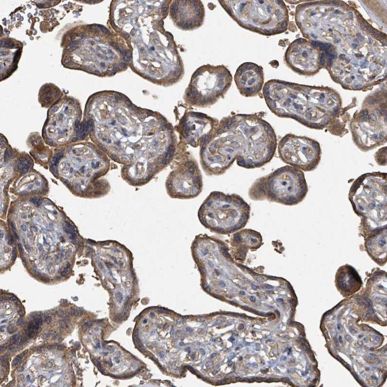 FENS1 Antibody - BSA Free Immunohistochemistry: FENS1 Antibody - BSA Free [NBP2-13521]