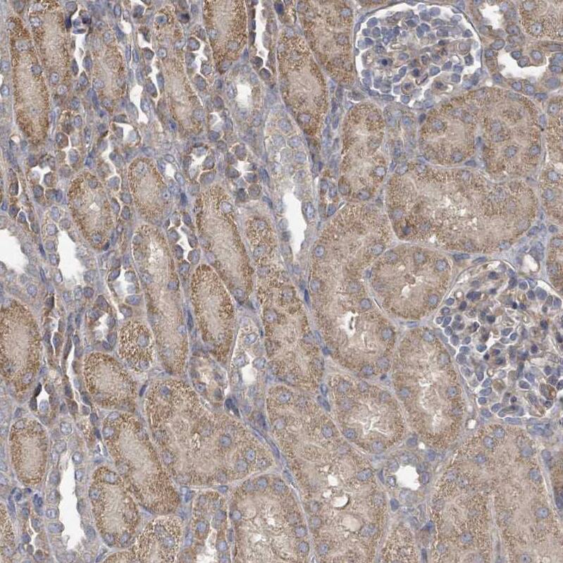 FENS1 Antibody - BSA Free Immunohistochemistry: FENS1 Antibody - BSA Free [NBP2-13521]