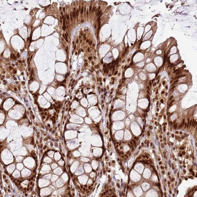 XRN2 Antibody - BSA Free Immunohistochemistry: XRN2 Antibody - BSA Free [NBP2-13529]