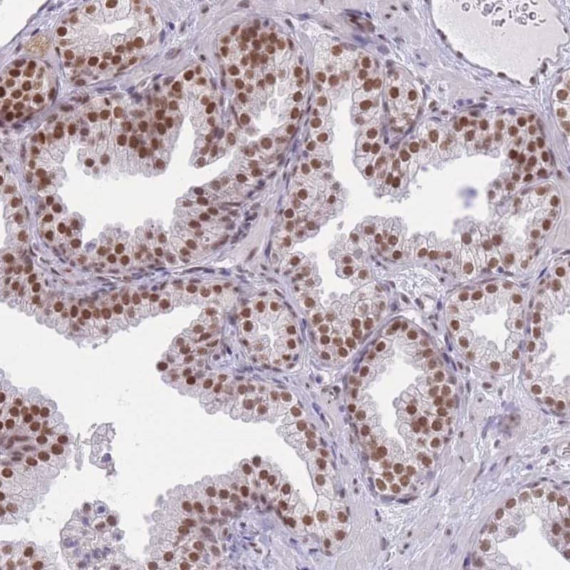 ZBED5 Antibody - BSA Free Immunohistochemistry: ZBED5 Antibody - BSA Free [NBP2-13532]