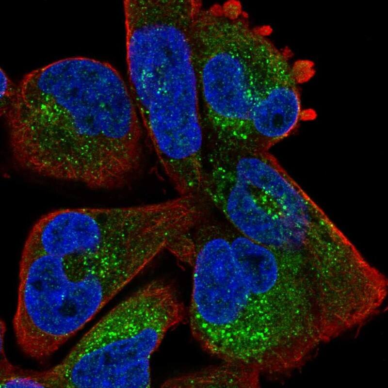 ZBTB39 Antibody - BSA Free Immunocytochemistry/ Immunofluorescence: ZBTB39 Antibody [NBP2-13535]