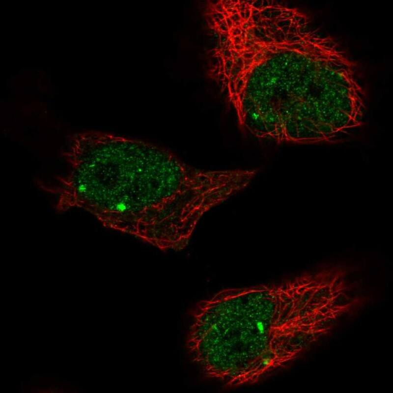 ZBTB5 Antibody - BSA Free Immunocytochemistry/ Immunofluorescence: ZBTB5 Antibody [NBP2-13536]