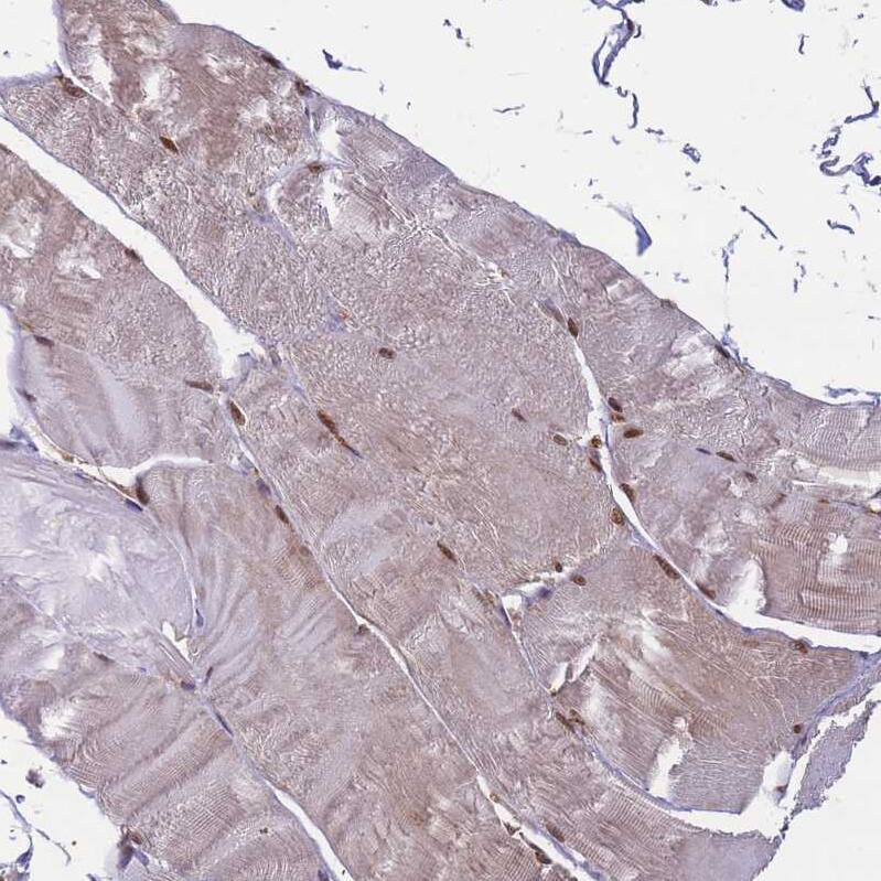 ZBTB5 Antibody - BSA Free Immunohistochemistry: ZBTB5 Antibody - BSA Free [NBP2-13536]