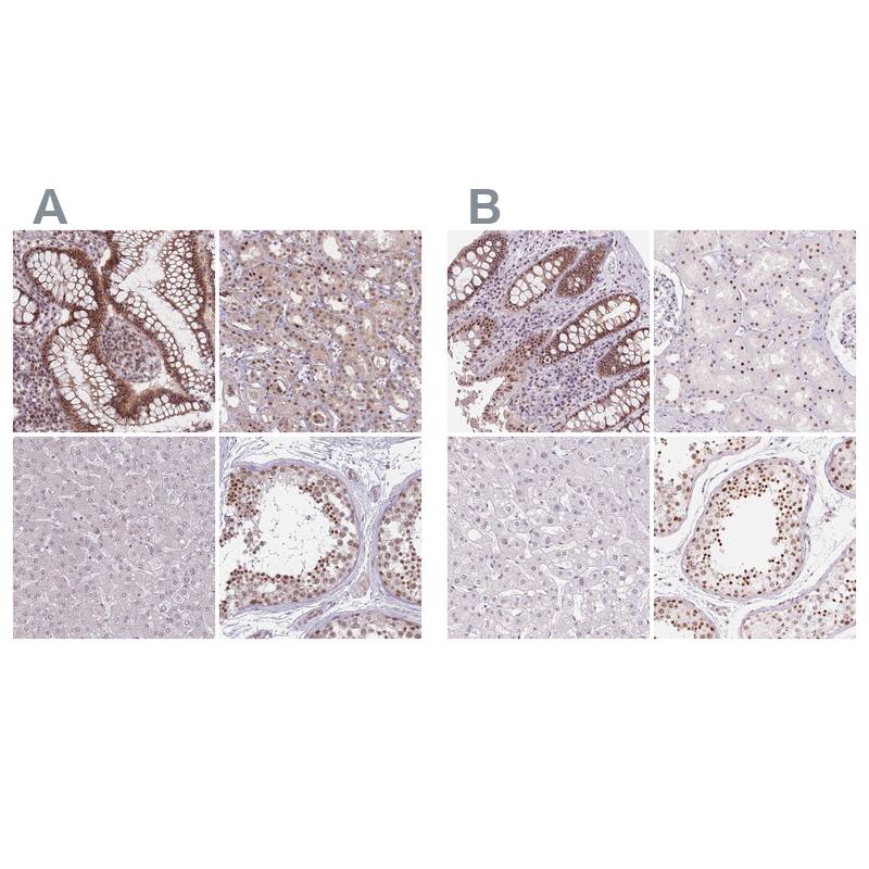 ZC3H14 Antibody - BSA Free Immunohistochemistry: ZC3H14 Antibody - BSA Free [NBP2-13537]