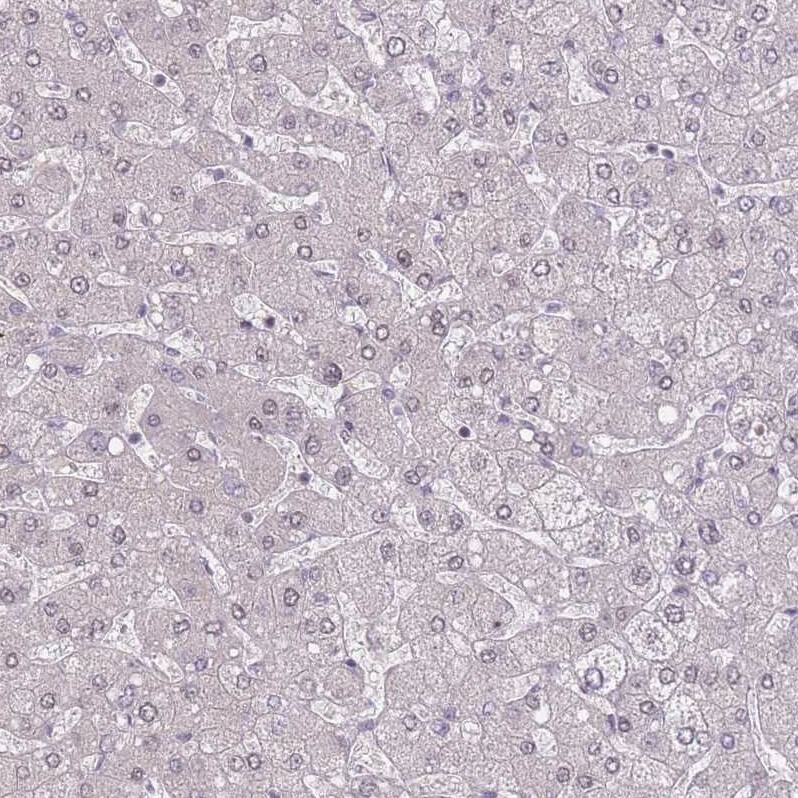 ZC3H14 Antibody - BSA Free Immunohistochemistry: ZC3H14 Antibody - BSA Free [NBP2-13537]