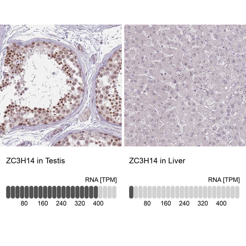 ZC3H14 Antibody - BSA Free Immunohistochemistry: ZC3H14 Antibody - BSA Free [NBP2-13537]