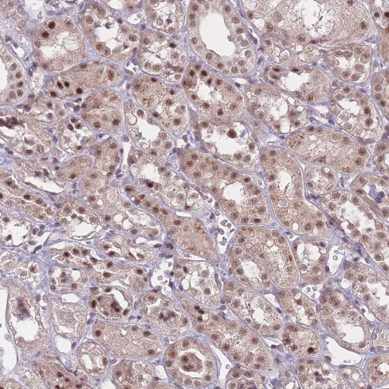 ZC3H14 Antibody - BSA Free Immunohistochemistry: ZC3H14 Antibody - BSA Free [NBP2-13537]