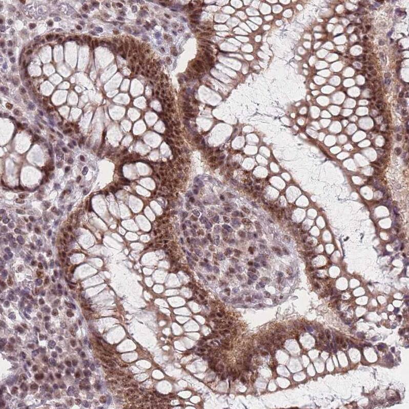 ZC3H14 Antibody - BSA Free Immunohistochemistry: ZC3H14 Antibody - BSA Free [NBP2-13537]