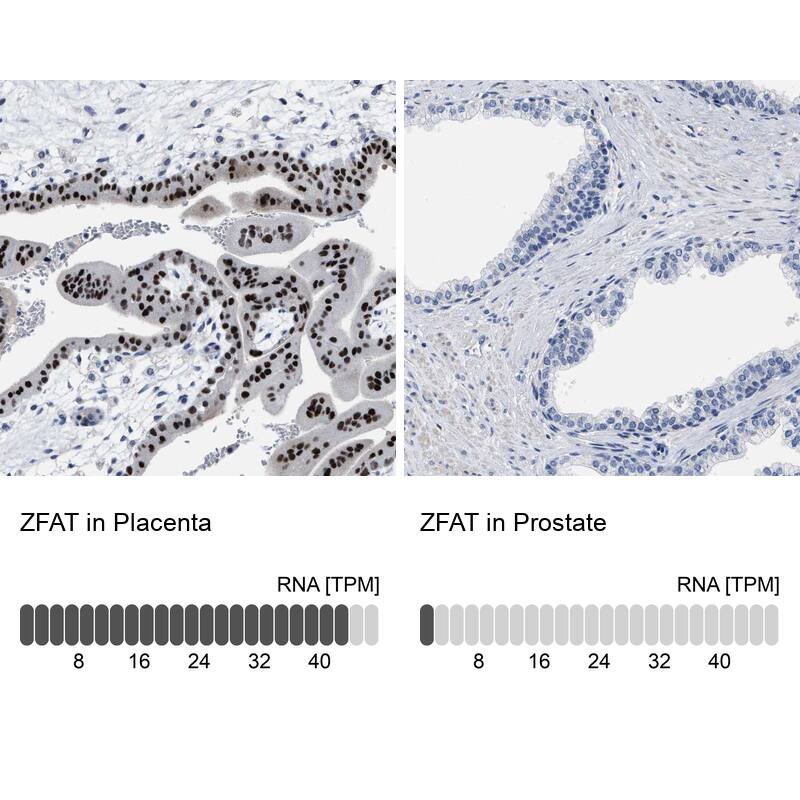 ZNF406 Antibody - BSA Free Immunohistochemistry: ZNF406 Antibody - BSA Free [NBP2-13542]