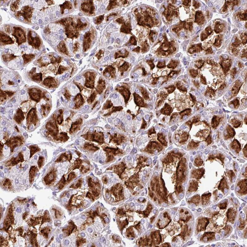 ZFP106 Antibody - BSA Free Immunohistochemistry: ZFP106 Antibody - BSA Free [NBP2-13543]