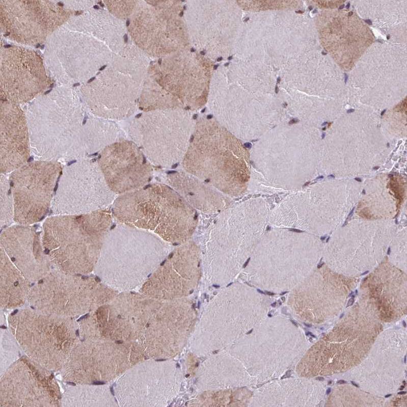 ZFP3 Antibody - BSA Free Immunohistochemistry: ZFP3 Antibody - BSA Free [NBP2-13545]