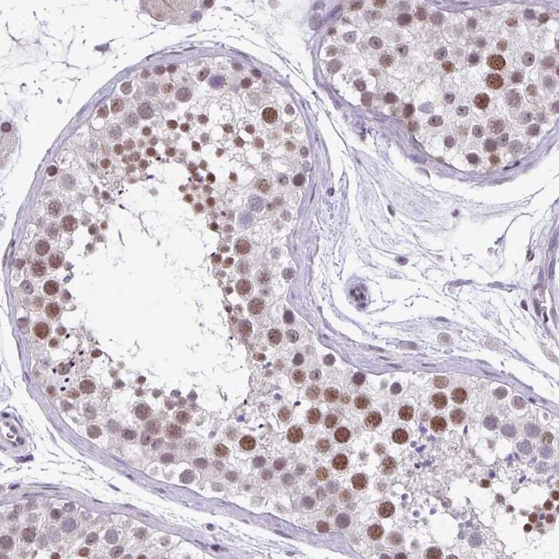 ZFP3 Antibody - BSA Free Immunohistochemistry: ZFP3 Antibody - BSA Free [NBP2-13545]